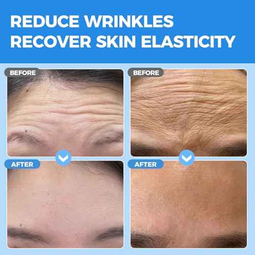 Okela Forehead Wrinkle Patches Overnight 20 pcs with Collagen, Anti Wrinkle Patches, Forehead Wrinkles Beauty Treatment