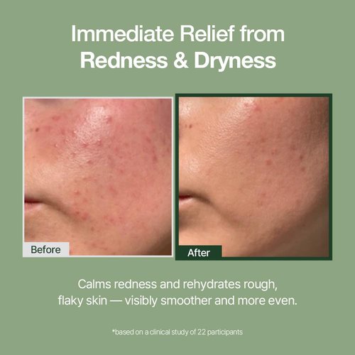 Natural Derma Project Green Caper Deep Hydration Cream - Soothing Moisturizer for Sensitive Skin (80ml)