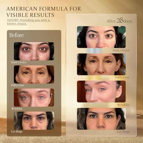 Retinol Under Eye Cream - Anti Aging Eye Cream for Dark Circles and Puffiness, Eye Bags, Wrinkles Fine Lines Skin Care Treatment Firming & Lifts for Man and Women - Gold 20ml