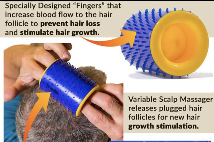 Magna Roller Scalp Massager for Hair Growth - Hair Loss Treatment for Men and Women with Thinning, Dry and Dull Hair - Increases Blood Flow to Scalp & Hair follicles for Thicker, Healthier Hair.