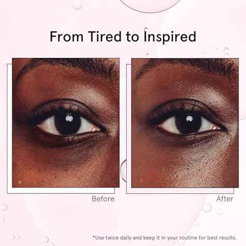 grace & stella Under Eye Brightener with Cooling Metal Rollerball - Ceramide & Caffeine Eye Cream for Puffy Eyes - Travel Size Toiletries - Vegan Skincare (15ml / 0.51floz)