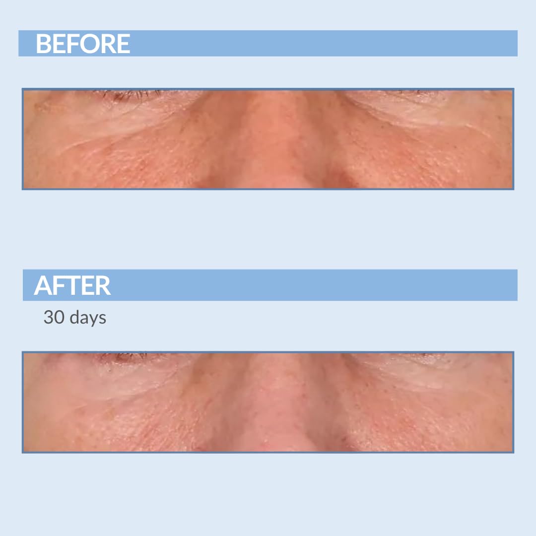 Serious Skincare Retinol Vitamin A Resurfacing Pads - Exfoliate Skin & Reduce Wrinkles - 60 Pre-Moistened Discs