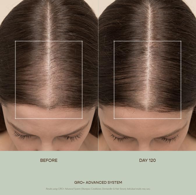 VEGAMOUR GRO+ Advanced Hair Serum - Boosts Hair Density & Reduces Shedding | Fragrance-Free, Vegan, Cruelty-Free