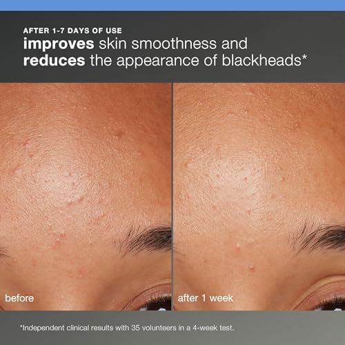 Dermalogica Discover Healthy Skin Kit - Includes: Precleanse, Face Wash, Face Exfoliator, & Moisturizer - Wash Away Impurities To Reveal Glowing Skin