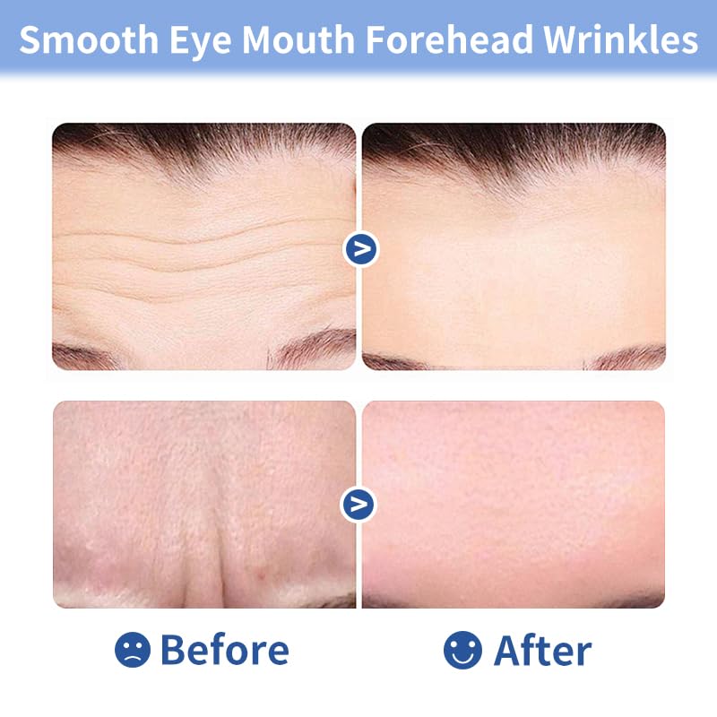 Medimama 20pcs Collagen Forehead Wrinkle Patches - BEAUMIT Series,jelly touch Skin-friendly hydrogel texture Anti-Wrinkle Patches with Glycerin,Deep Hydration & Firming