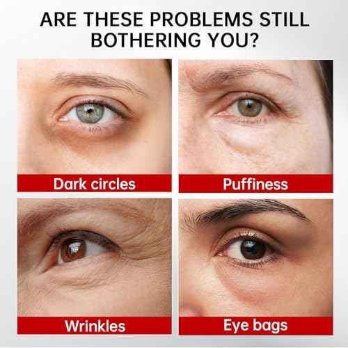 Retinol & Caffeine Eye Serum -360¡Æ Massage Roller for Puffiness,Eyebag Remover,Wrinkle Filler,Under Eye Cream For Dark Circles 0.54fl.oz (Pack of 1)