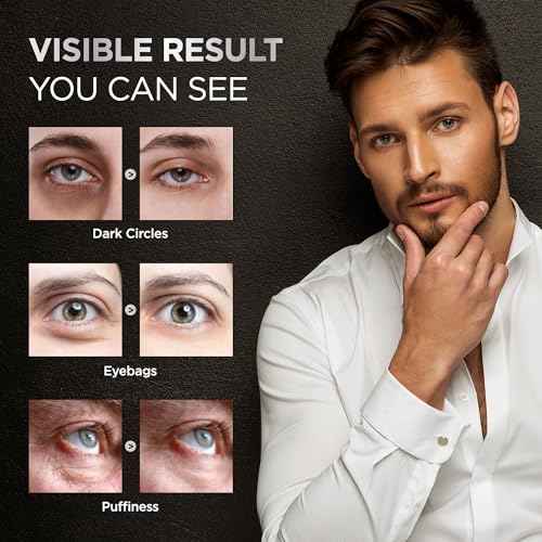 Under Eye Cream for Puffiness and Bags: Caffeine Serum Roller for Dark Circles Treatment - With 5% Caffeine Retinol Hyaluronic Acid Niacinamide Peptides 0.5 fl. oz