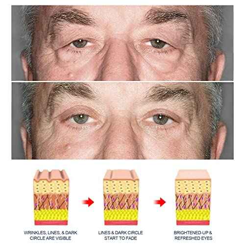 3PCS Awaken Peptide Depuffing Eye Gel, Peptide Lifting Eye Gel, Lifts Firming Anti-Wrinkle Eye Tightener, Natural Moisturizing Eye Cream for Reduces Puffiness/under Eye Bags/Dark Circles/Wrinkles