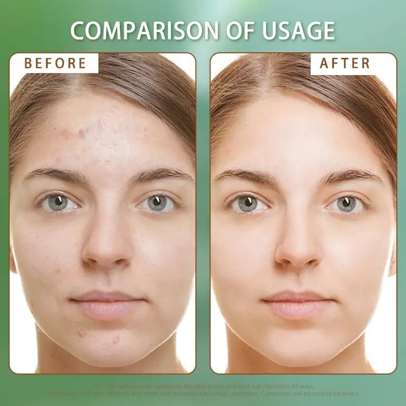 Skiennix Microcrystal Deep Cleansing Gel Scrub - 2% BHA & Glycerin for Acne-Prone Skin, 4 oz