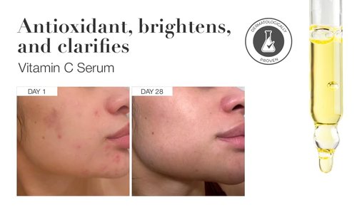Infinitek Paris | Vitamin C Face Serum | Hydrating & Brightening Antioxidant | 1 fl oz / 30 ml
