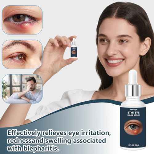 Stye Eye Treatment, Eye Reflief Serum for Styes and Chalazions, Non-Irritating, Eyelid Comfort Serum, Plant-based Formula, , (30ML-1 Fl Oz)
