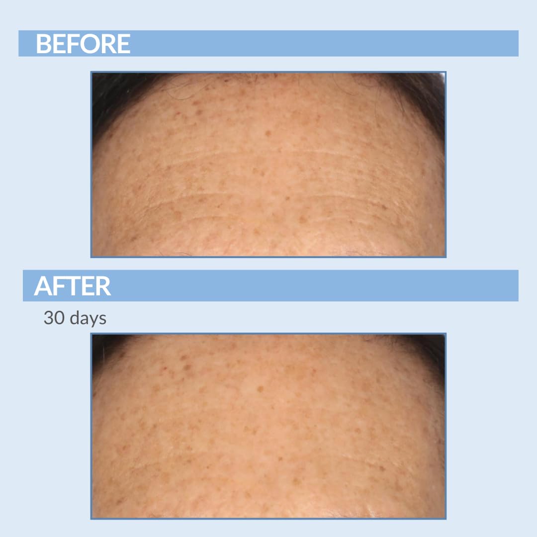 Serious Skincare Retinol Vitamin A Resurfacing Pads - Exfoliate Skin & Reduce Wrinkles - 60 Pre-Moistened Discs