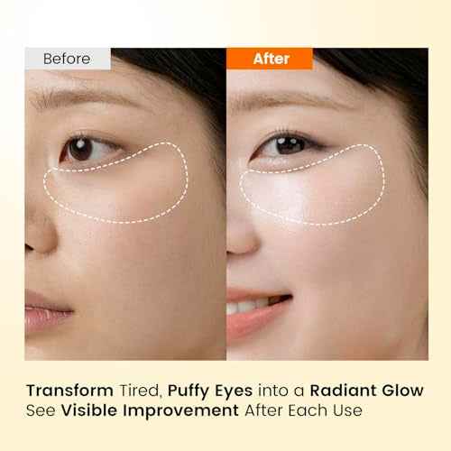 Caffeine Under Eye Patches: 30 Pairs Korean Hydrogel Eye Masks for Dark Circles Puffiness Relief with Niacinamide Hyaluronic Acid - Undereye Brightening Hydrating Anti-Wrinkle Treatment