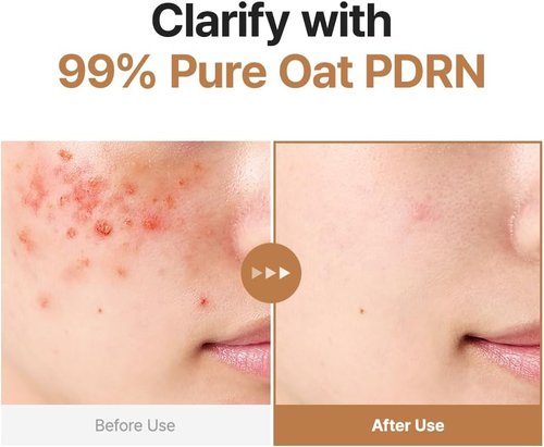 PURITO Oat PDRN Gentle Refining Toner - Hydrating & Clarifying Formula for Acne-Prone Skin | 200 mL (6.76 fl. oz)
