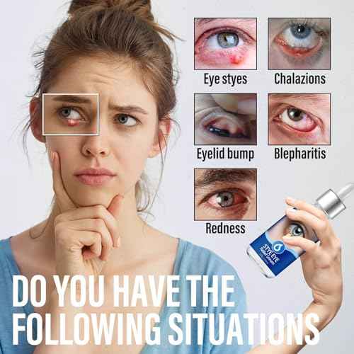 Stye Eye Treatment, Natural Stye Remover, Eye Stye Relief Serum, Premium Formula - Gentle Cleanser for Chalazion & Blepharitis (1 Fl Oz (Pack of 1))