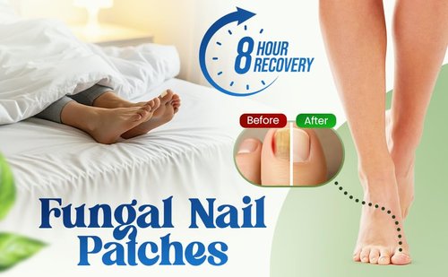Premium Fungal Nail File Patches Toe Foot Repair Care Extra Fungus Strength 21 Pcs Nighttime Damaged Treatment tolnaftate Toenail ingrown Nails Strengthen 8 Hour Safe Sensitive gift for Women Men.