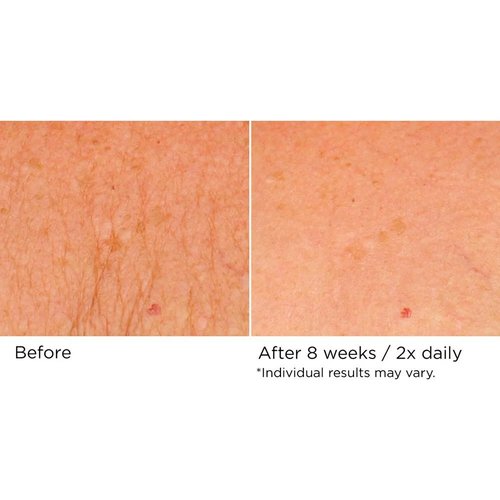 NassifMD Neck & Decollete Firming Complex - Lifting Treatment for Youthful Skin