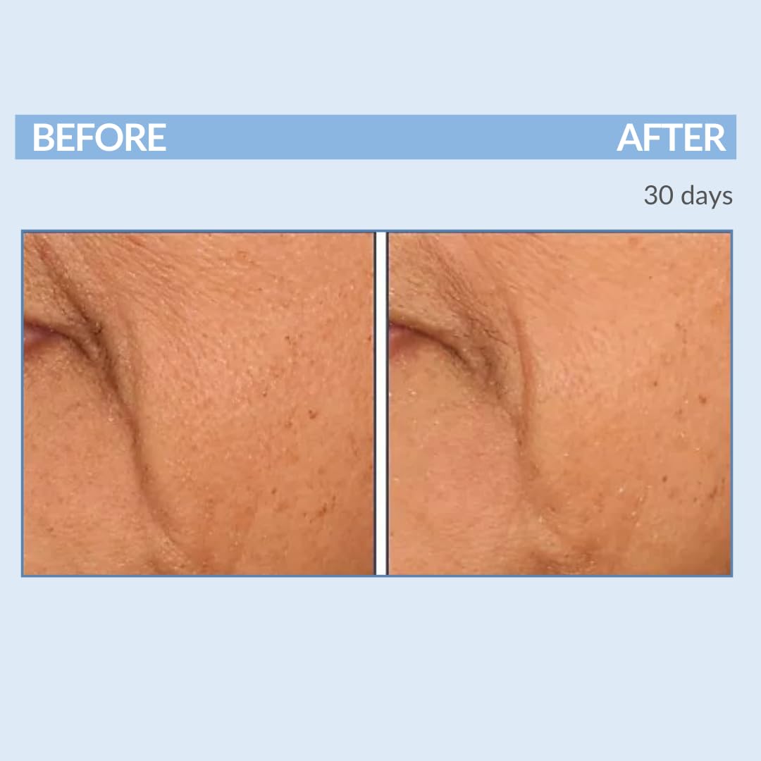 Serious Skincare Retinol Vitamin A Resurfacing Pads - Exfoliate Skin & Reduce Wrinkles - 60 Pre-Moistened Discs