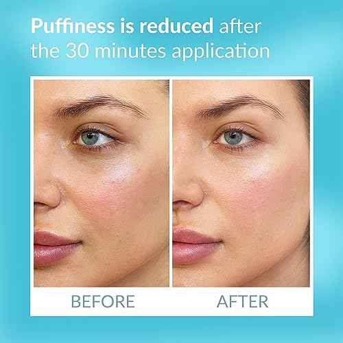 Talika Eye Therapy Patch - Instant Smoothing Under Eye Patches - For Dark Circles Puffiness & Tired Eyes - Reusable Under Eye Patch Skincare Eye Treatment