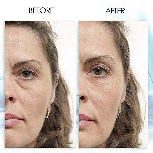 Puffy Eye GEL Instant results ? Naturally rapid reduction eye gel, Eliminate Wrinkles, Puffiness and Bags ? Hydrating Eye Gel w/Green Tea Extract by Aqua Mineral ? 1 oz