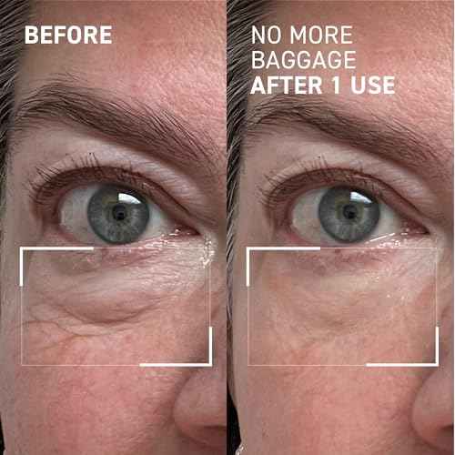 Dr. Brandt Needles No More, No More Baggage - Minimizes Under-Eye Bags, Puffiness & Dark Circles - 0.5 oz