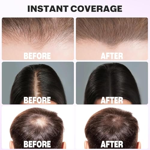 Acomler Instantly Root Cover Up Powder - Hairline Shadow, Touch Up for Thinning, Grey Hair, Eyebrows, Beard Line, Bald Spots (Auburn)