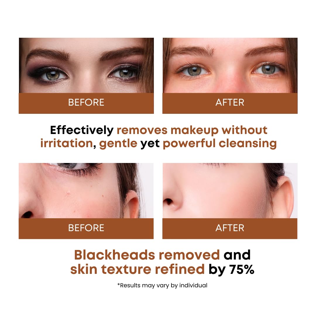 Skiennix Rice Water Cleansing Pads - Exfoliating Makeup Remover & Toner with Centella Asiatica | 50 Pads