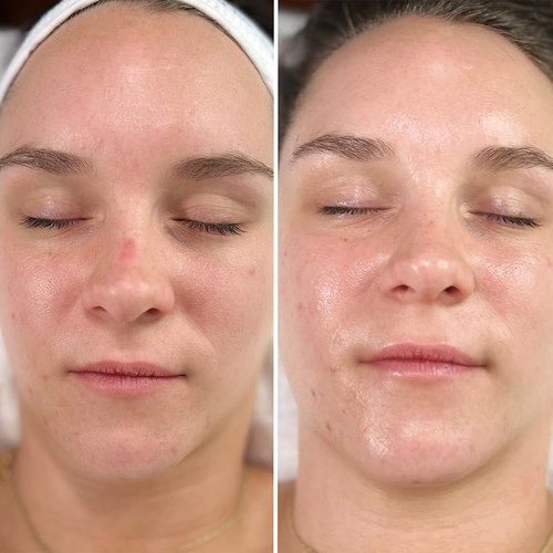 Intraceuticals Rejuvenate Daily Serum - Hydrating Anti-Aging Formula for Radiant Skin