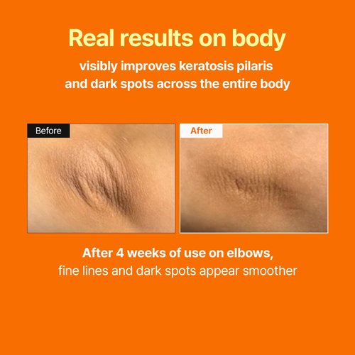 MEDITHERAPY Retinal Skin Booster Serum - Anti-Aging Retinaldehyde & Niacinamide | Hydrating Facial Serum for All Skin Types, 5.07 fl oz