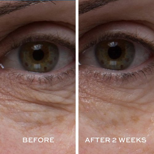 ELEMIS Peptide4 Eye Recovery Cream - Revitalizing Formula for Bright Eyes | 0.5 Fl Oz
