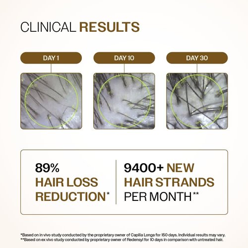 Bare Anatomy Advanced Hair Growth Serum - 3% Redensyl for Enhanced Results | 30mL | Hair Growth & Fall Control for Men & Women