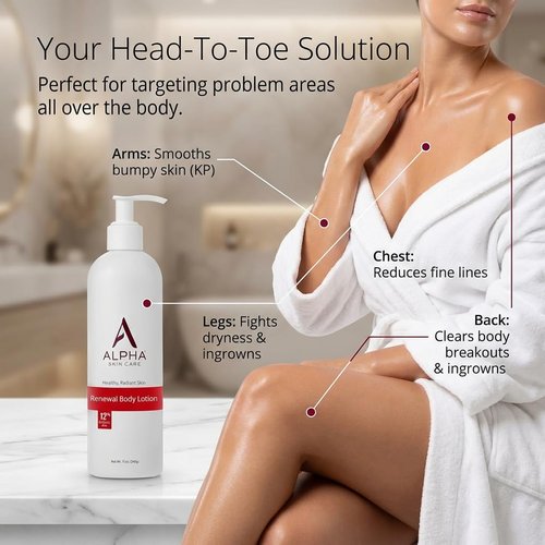 Alpha Skin Care Revitalizing Body Lotion with 12% Glycolic AHA, Simple and Effective Multi-Purpose Daily Moisturizer Hydrates and Exfoliates with Anti-Aging