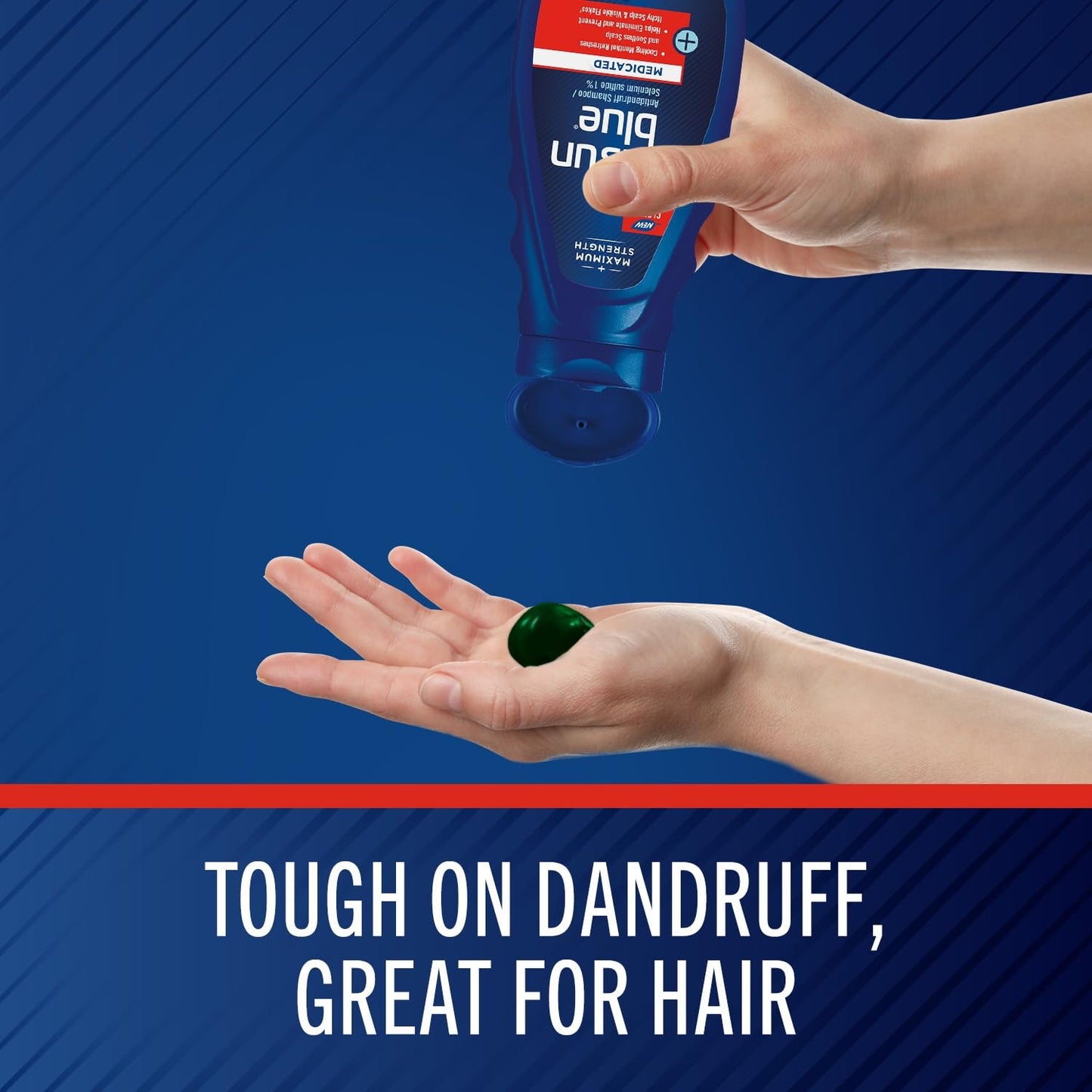 Selsun Blue Medicated Antidandruff Shampoo - Maximum Strength Scalp Treatment with Selenium Sulfide | 11 fl. oz.