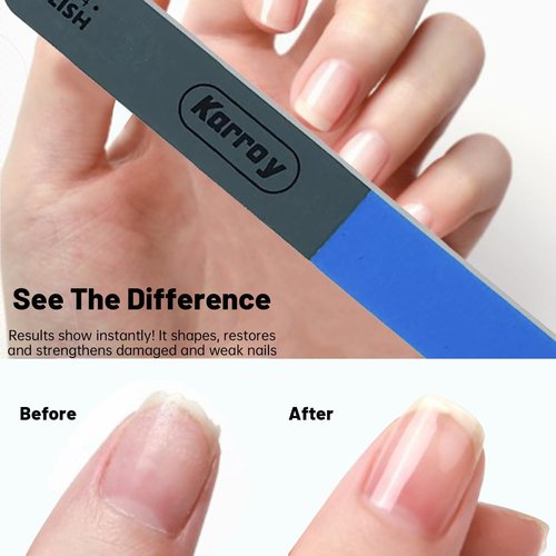 Regine Switzerland Nail File and Buffer Set - Dual-Sided 4-Step Tools for Shortening, Shaping & Smoothing | 20 Pieces
