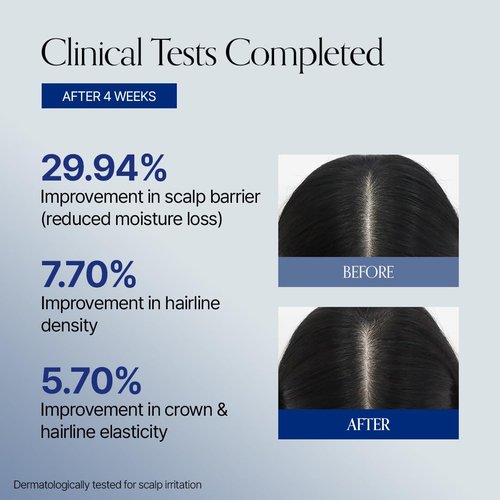 GROWUS Hair Booster Serum - Biotin & Spicule Formula for Thinning Hair - 14ml Scalp Treatment