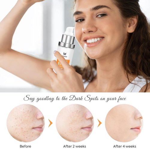 Regine Switzerland Dark Spot Remover - 5% Niacinamide Anti-Aging Fade Cream for All Skin Types