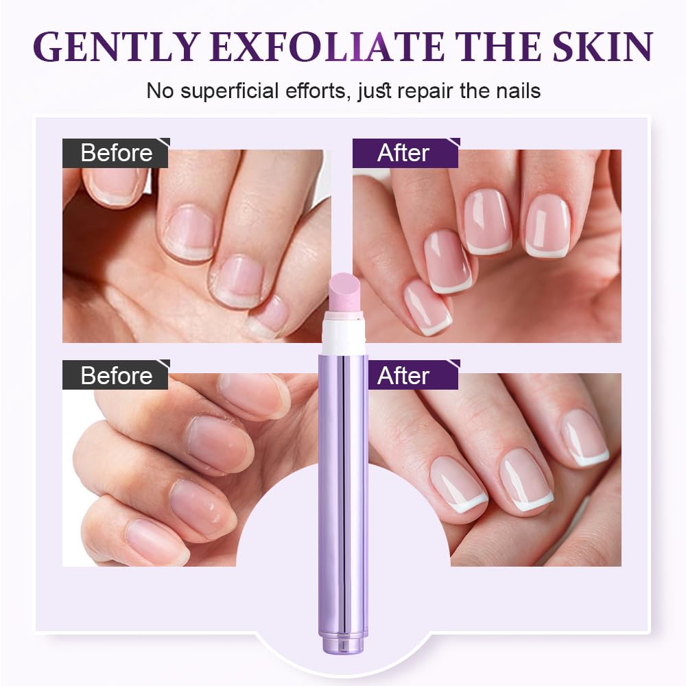 Skiennix 3 In 1 Nail Care Pen - Upgrade Cuticle Treatment with Ceramic Tip for Damaged Nails | 1 PC