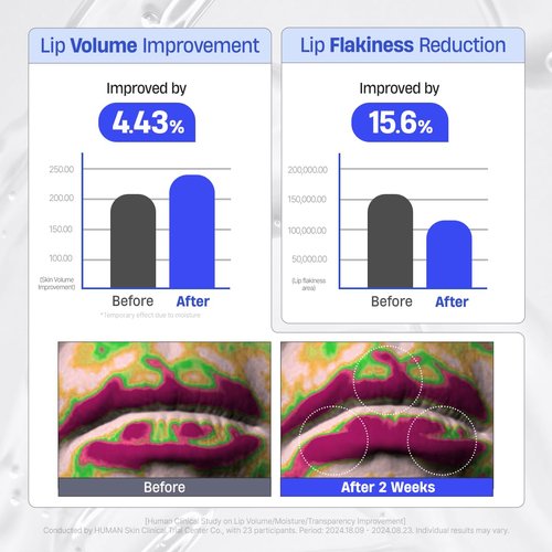 DERMATORY Hyalluron Peptide Volume Lip Mask Balm - Hydrating & Moisturizing for Day & Night (10ml)