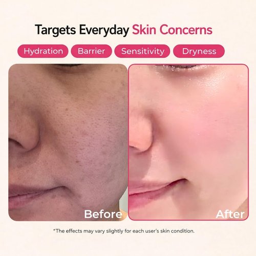 **Regine Switzerland Ceramide Lotion - Fragrance-Free Moisturizer for Dry & Sensitive Skin | 100 ml**