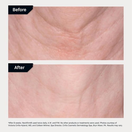 Revision Skincare Nectifirm Advanced® Neck Cream - Firm, Lift & Contour Neck, Jawline & Décolletage