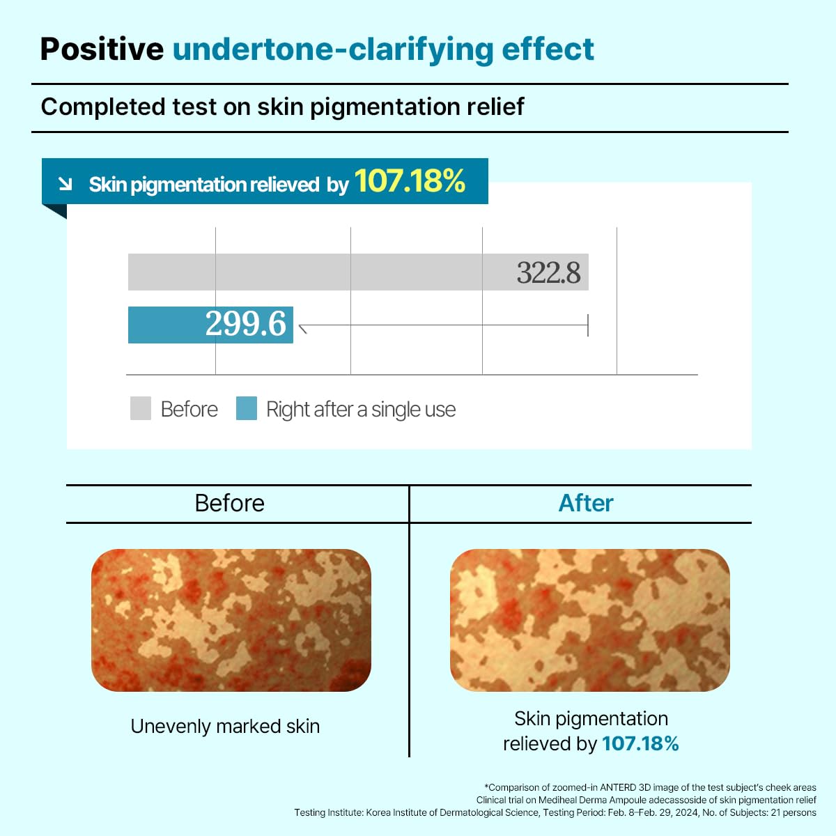 Mediheal Derma Modeling Pack (Madecassoside)*2 - Relieving Blemish Marks For Clear Skin - Easy DIY Home Spa Kits, Hydrating Icy Jelly Mask For Skin Refreshment