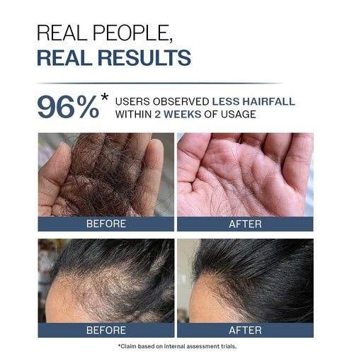 Bare Anatomy Anti Hair Fall Shampoo | 5x Hair Fall Control & Growth | Contains Biotin Adenosine, & Peptides | For All Hair Types | For Women & Men | 100ml