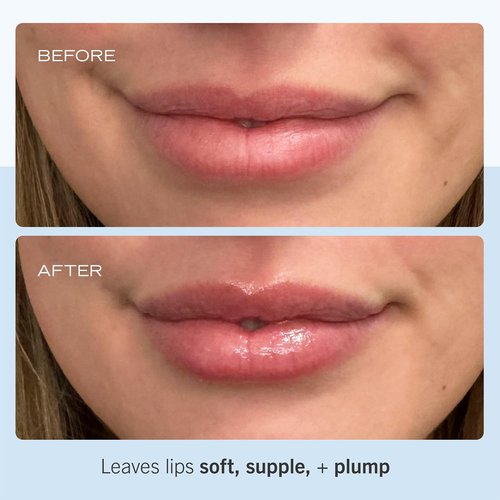 First Aid Beauty - Ultra Repair Lip Balm, Instant Hydration and Moisture for Soft, Supple & Plump Lips, Concentrated Formula of Botanical Oils, Butters & Waxes, Cruelty Free, 0.25 oz