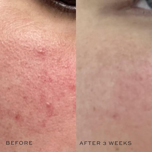 DIME Beauty Super Skin Toner - Alcohol-Free Witch Hazel Hydrating Formula with Aloe Vera & Cucumber Extract | 4 oz / 120 ml