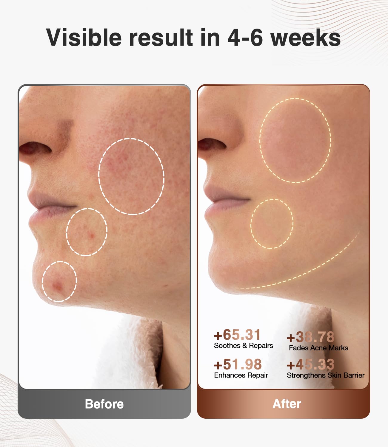 JOVS Red Light Therapy for Face, LED Light Therapy Beauty Device for Face, 4 Modes and Portable Skin Care Tools for Home Use