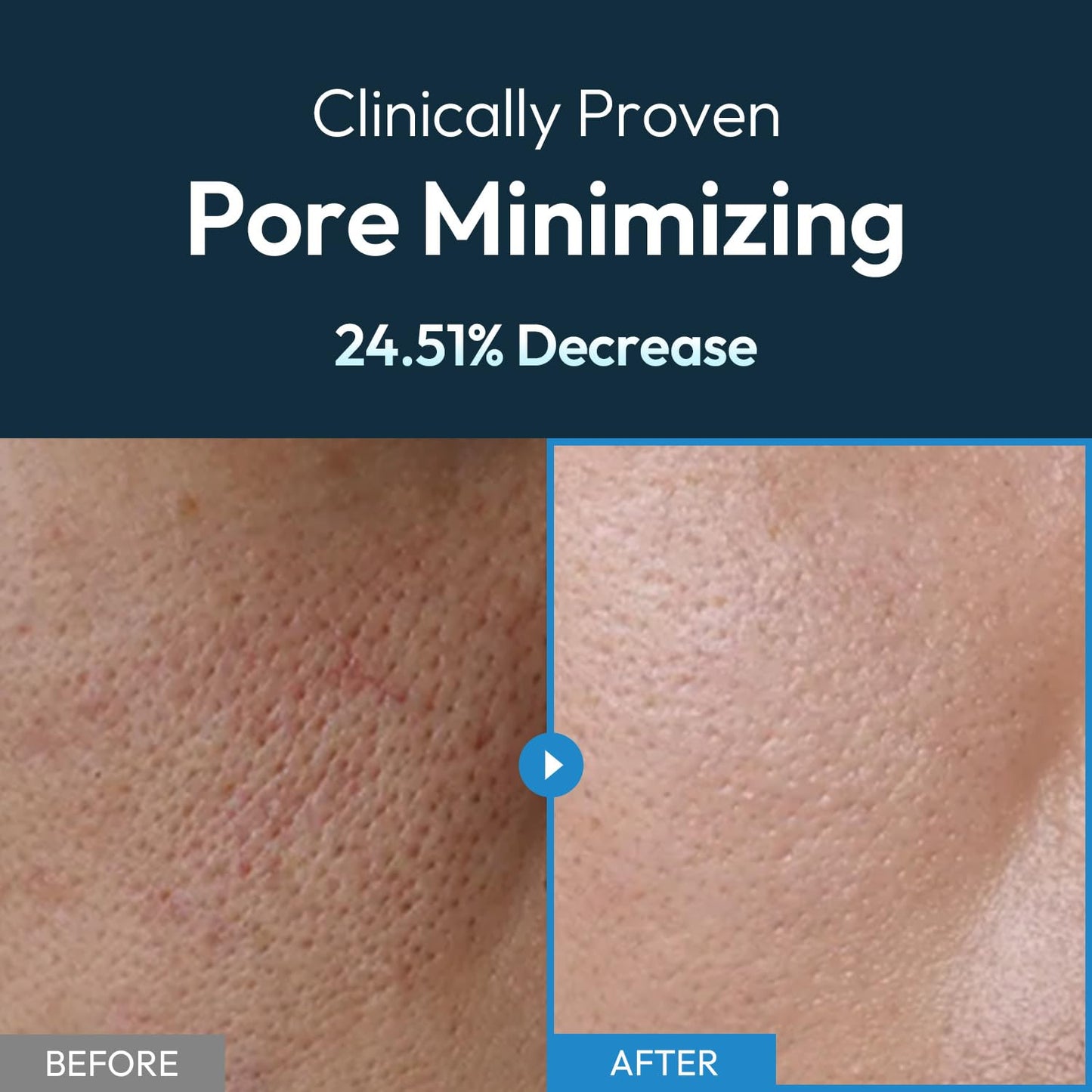 Skiennix Men's Face Moisturizer Gel - Oil Control & 24-Hour Hydration - Non-Greasy, Pore Minimizing, 3.71 fl oz