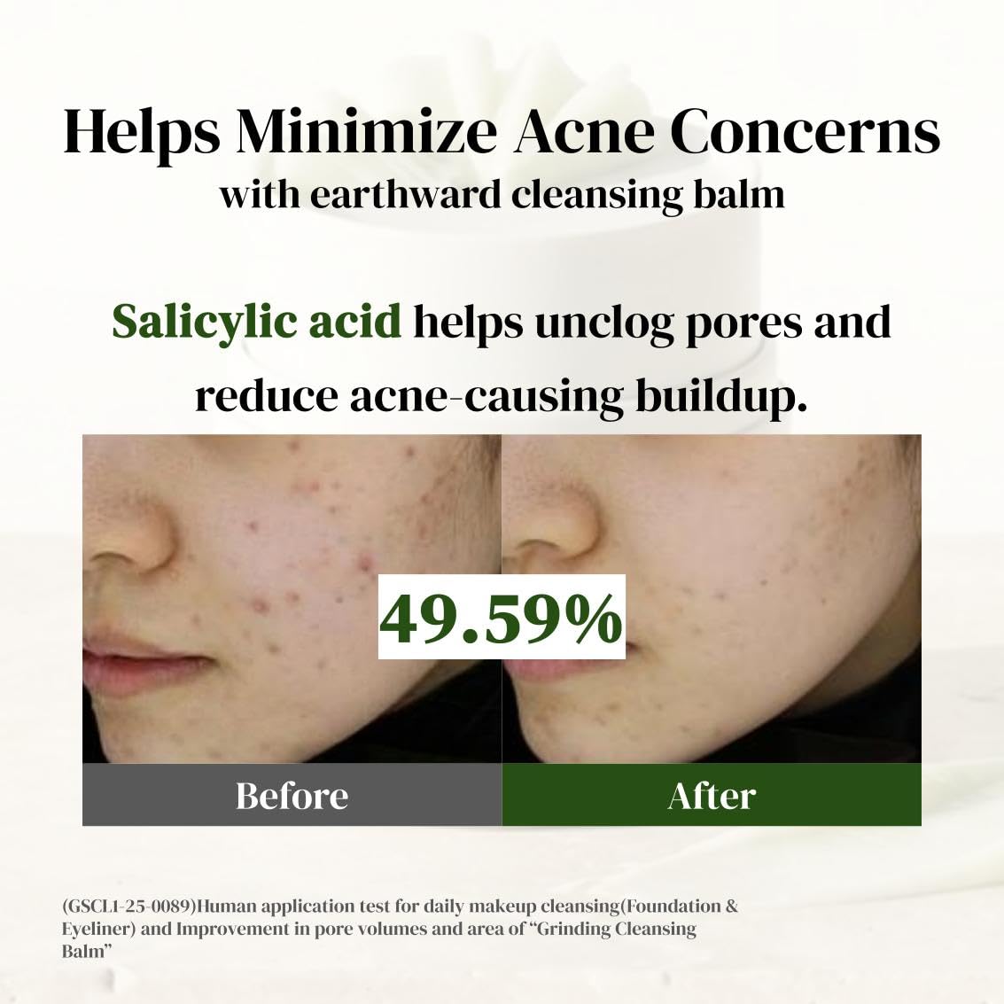 Skiennix Pore Perfect Cleansing Balm - Gentle Makeup Remover for Waterproof Eye Makeup | Oil Control & Blackhead Prevention