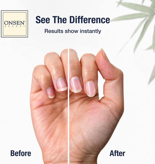 Onsen Nail Shape & Shine Kit - 3-Way Buffer Block with Extra Pads & 6-Pack Professional Files for Natural & Acrylic Nails