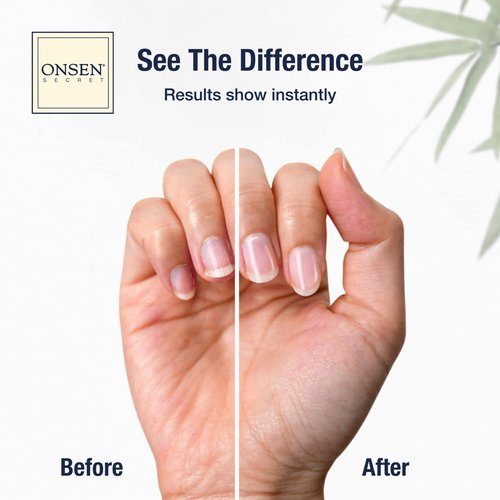 Onsen Secret Nail Care Kit | Spa-Quality Organic Cuticle Oil & Nail Buffer - 10ml - Long-Lasting Shine