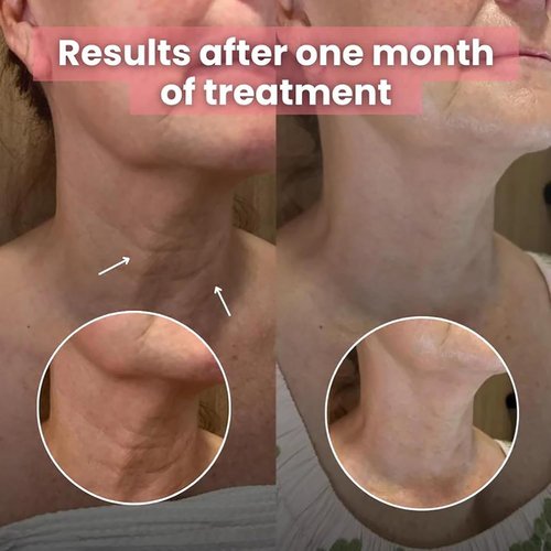 Korean Bio-Collagen Necklift Mask - Hydrating & Firming Silicone Patches for Youthful Neck (2 Pack)